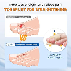 HYGGEAR™ Hammer Toe Straightener Corrector Splint For Fixing Your Toes